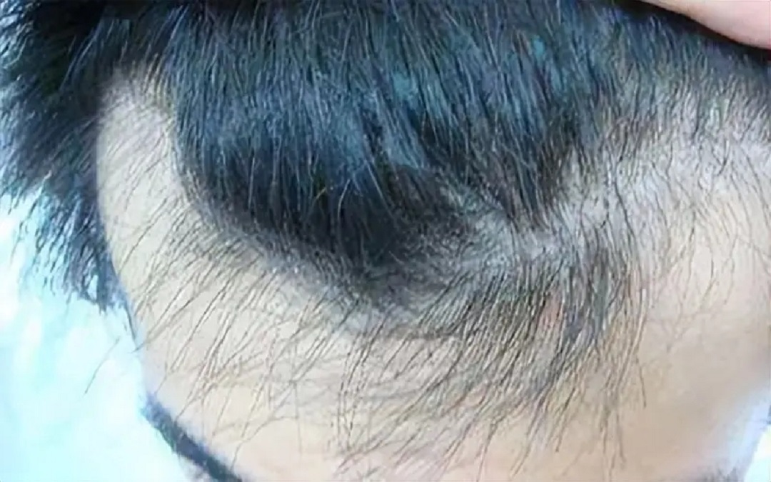 图片细节