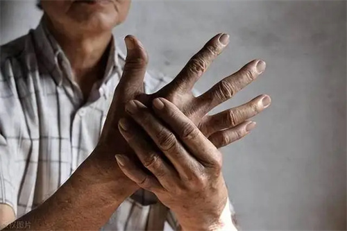 详细说明