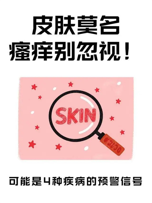 细节介绍
