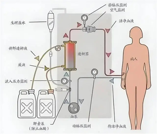 详细说明