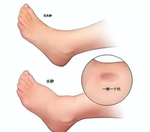 细节说明