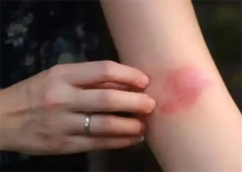 细节介绍