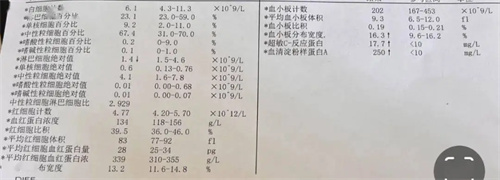 细节介绍