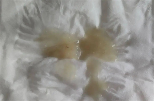 细节说明