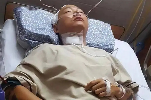 详细说明