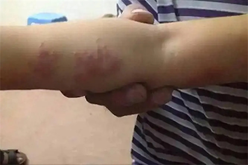 详细描述