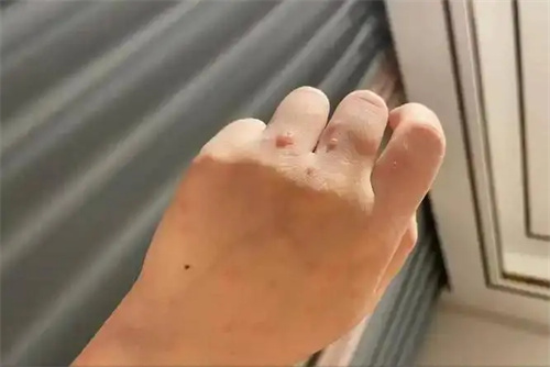细节呈现