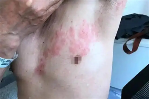 详细说明