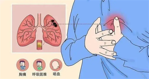 详细描述