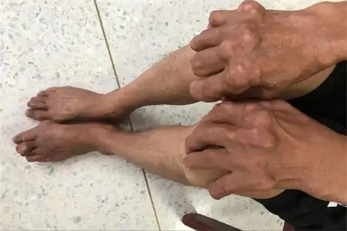 详细展示