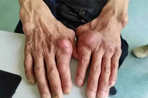 细节介绍