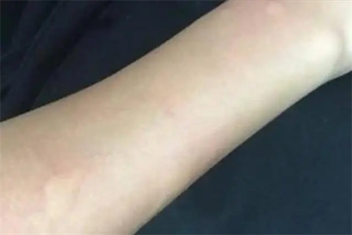 细节说明