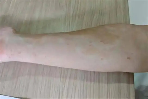 详细说明