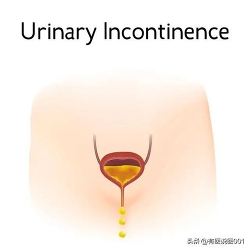 细节呈现