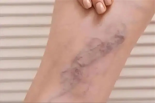 细节介绍