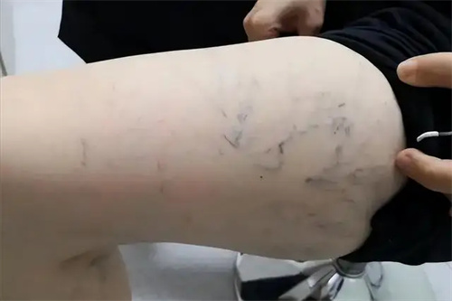 详细说明