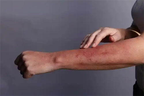 详细说明