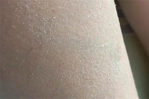 详细说明