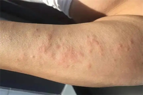 细节说明