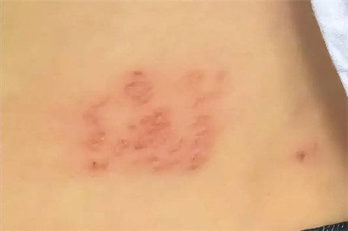 细节介绍